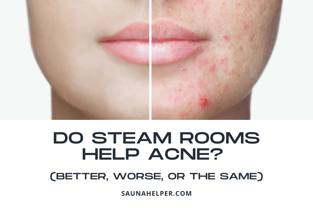 Do Steam Rooms Help Acne? (Better, Worse, or the Same)